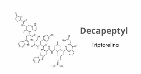 Quando finiscono gli effetti collaterali di Decapeptyl?